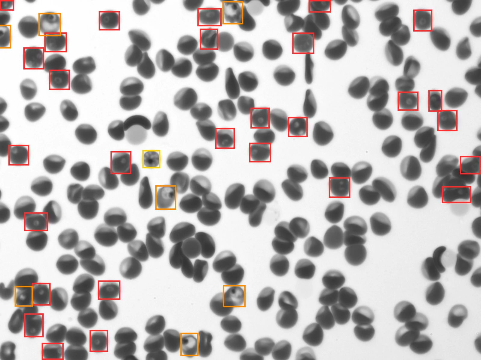 Malaria parasites classified by life-cycle stage — ring, trophozoite, and schizont — with bounding boxes from the YOGO model