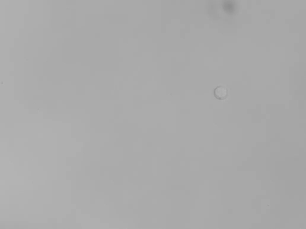 Cerebrospinal fluid imaged by Remoscope