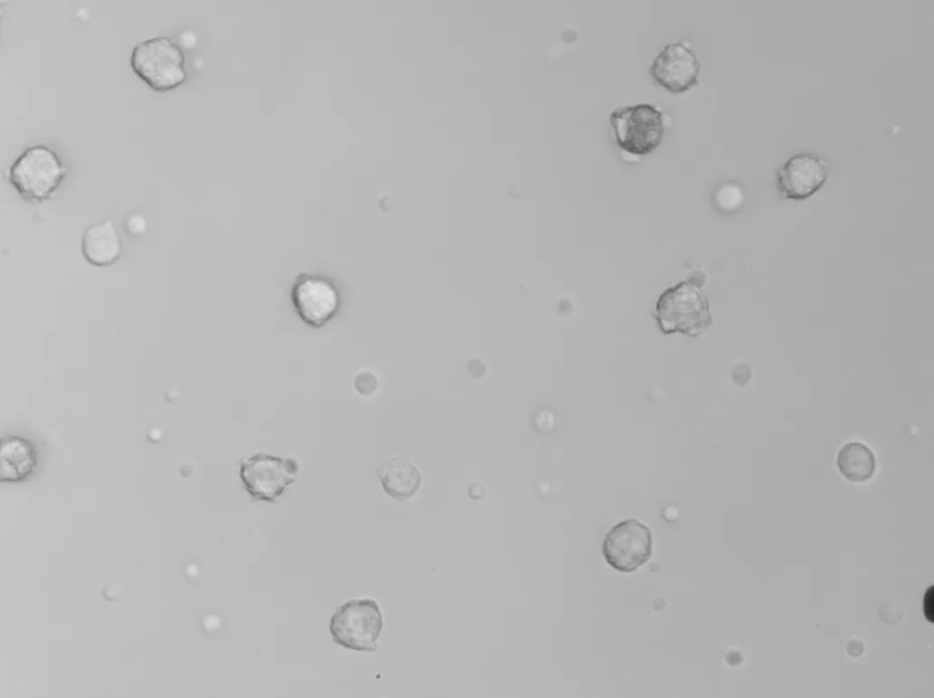 White blood cells imaged by Remoscope