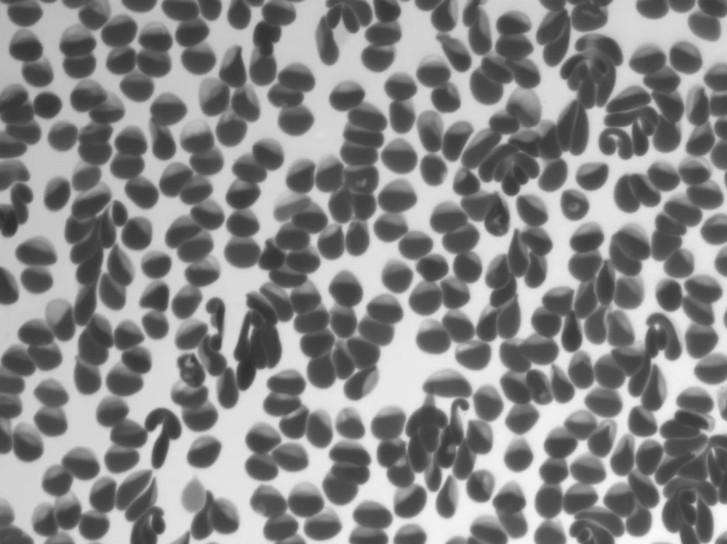 P. falciparum-infected cells imaged by Remoscope