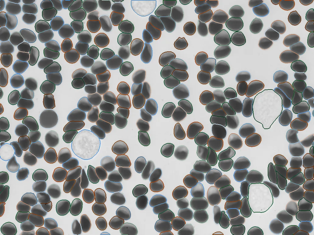 Instance segmentation mask overlay